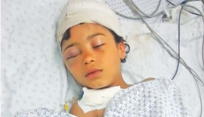 83_Zionist_Terror_in_Gaza-girl_in_bed_AGC3