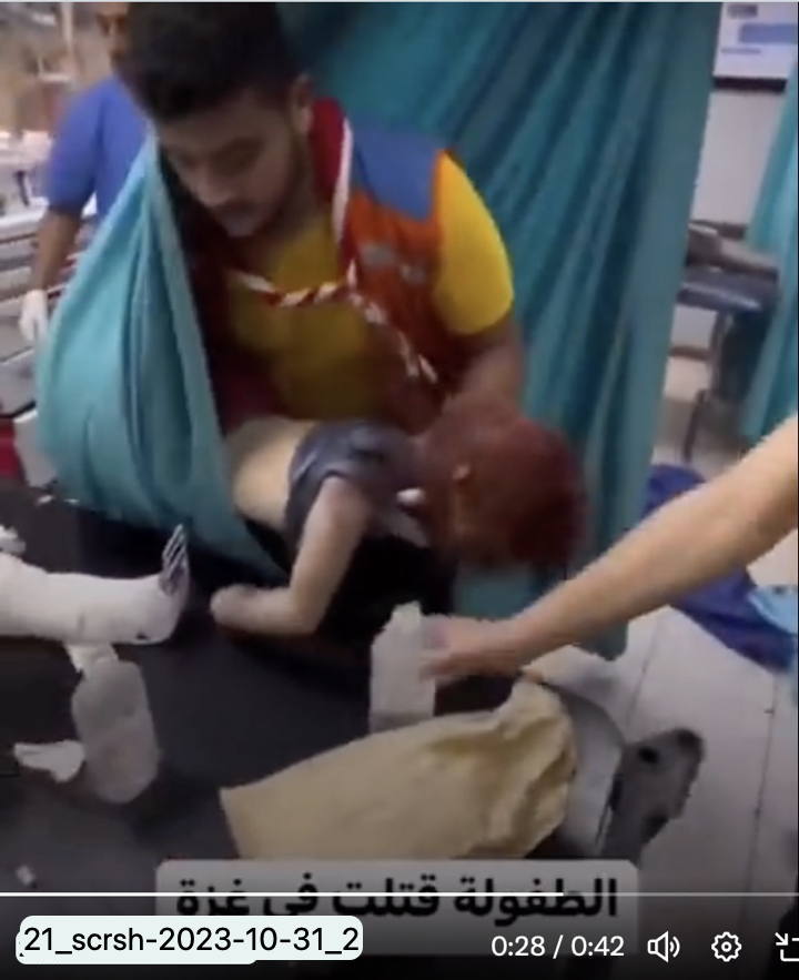 Children toddlers Gaza hospital ICU