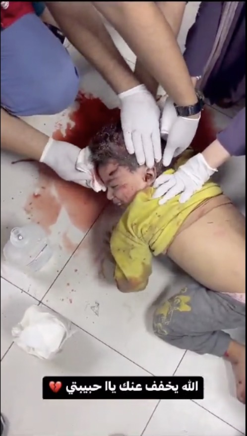 Children toddlers Gaza hospital ICU